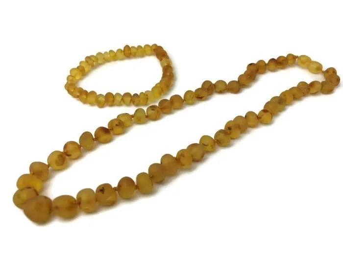 Raw unpolished 16 17 inch Honey Baltic Amber Necklace for Big Kid, Child, Teen, or Adult